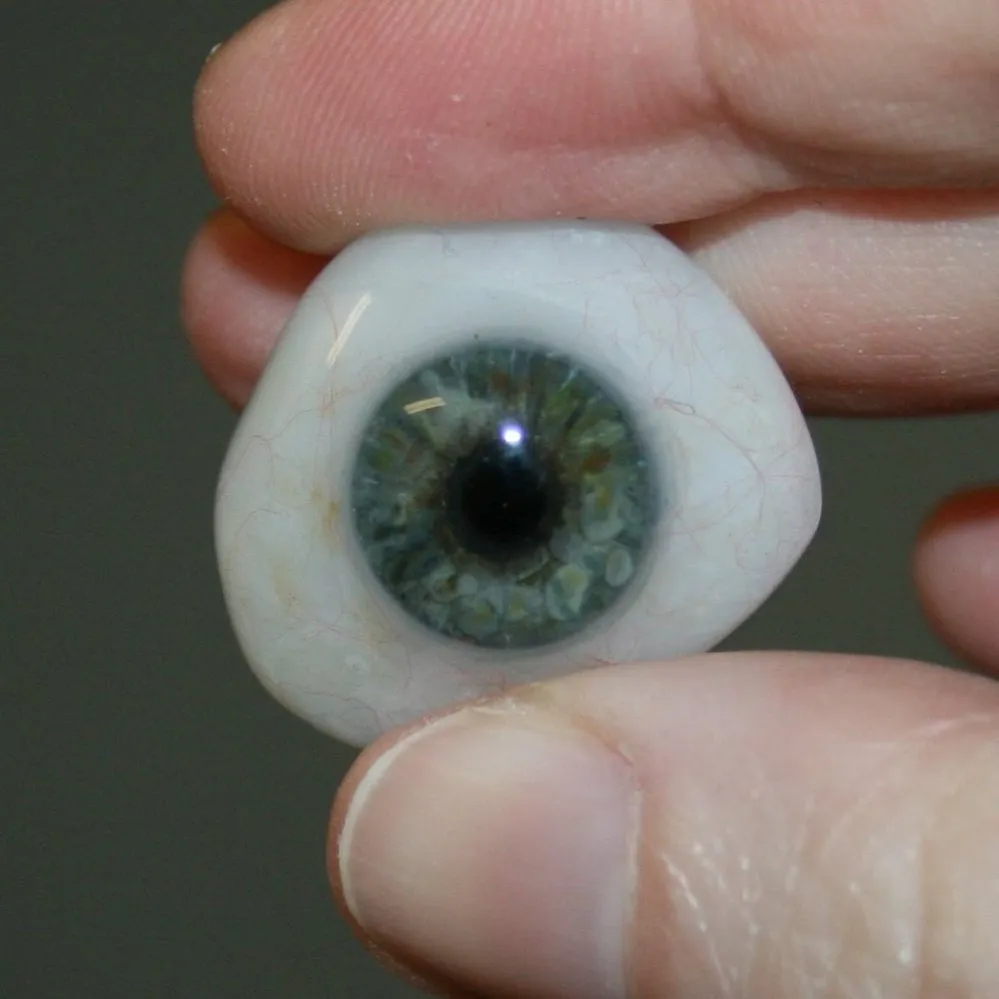 A bespoke prosthetic eye being carefully shaped during a personalised fitting session, highlighting the collaborative crafting process