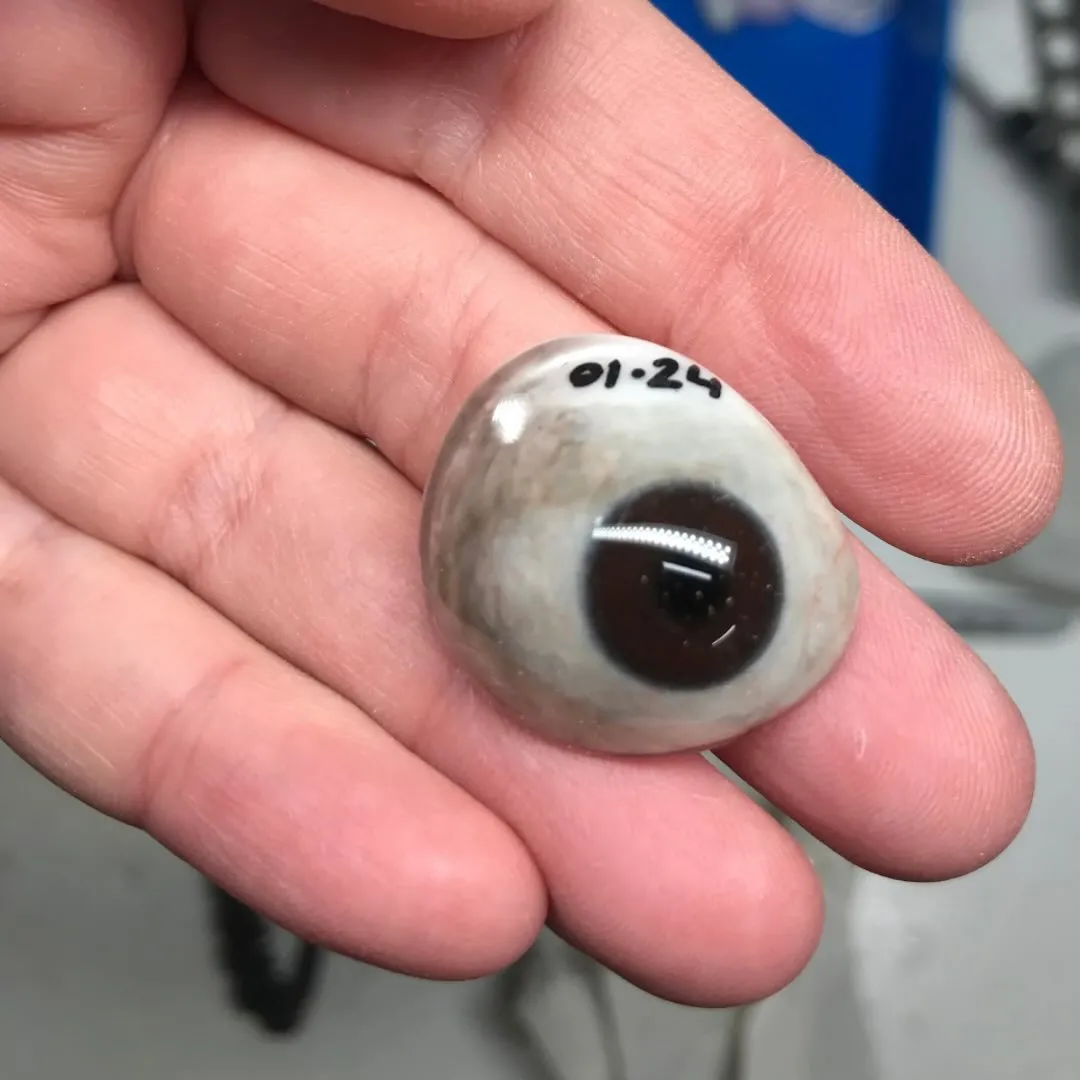 Bespoke prosthetic eye shaped and polished for a precise, comfortable fit, held gently in the ocularist's hand