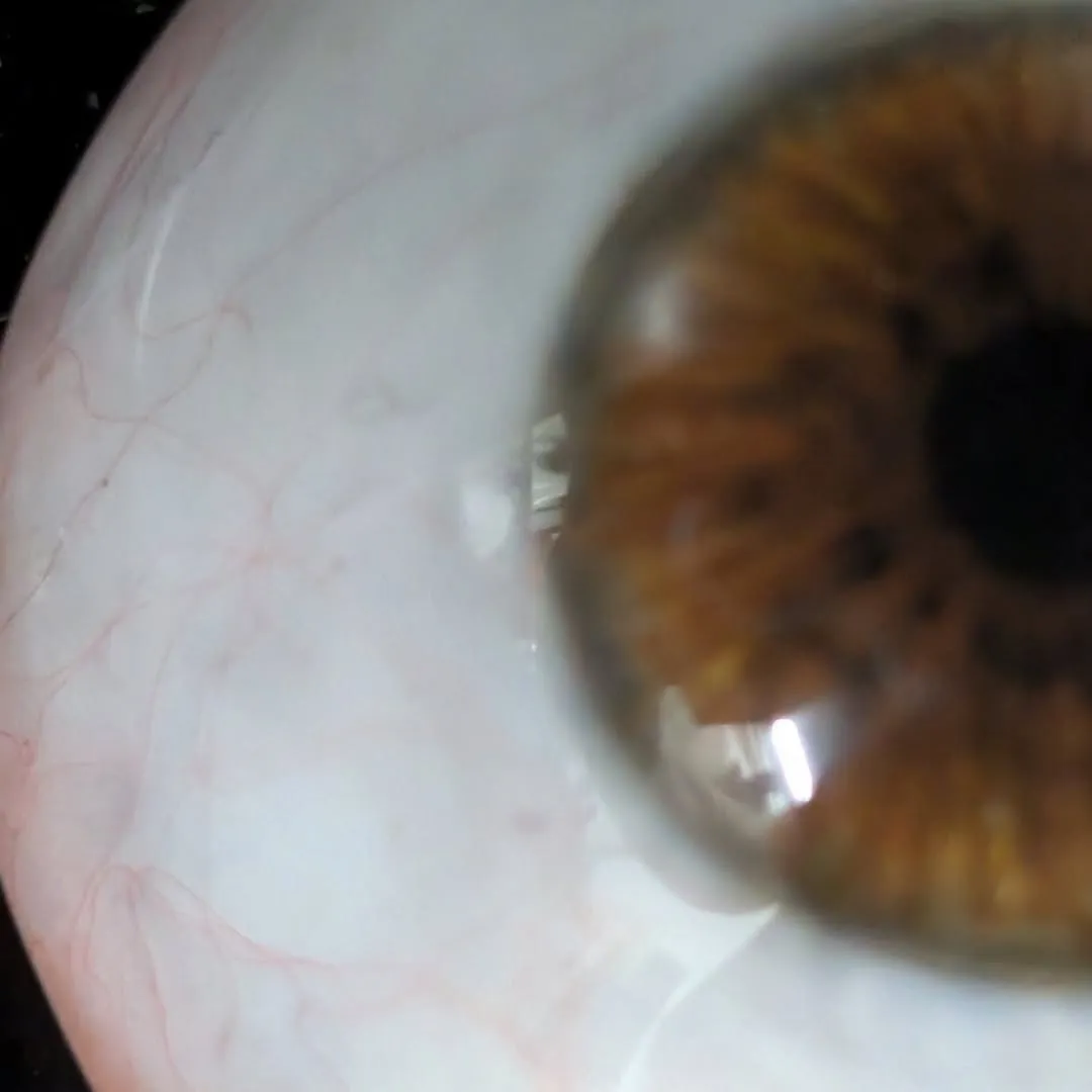 Prosthetic eye photographed in multiple lighting conditions, revealing how the hand-painted iris shifts between warm amber and cool grey tones