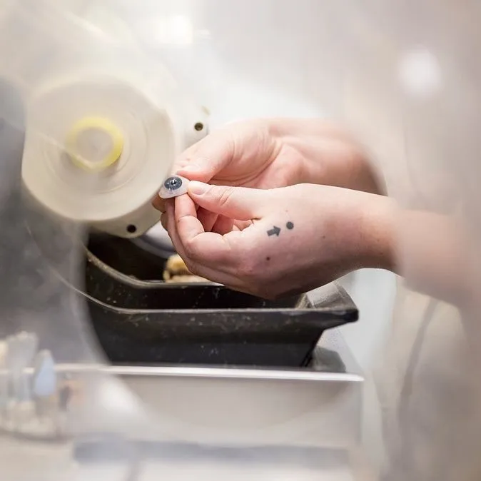 Expertly crafted prosthetic eye showcasing over a decade of ocularist artistry, with lifelike iris detail and natural colouring